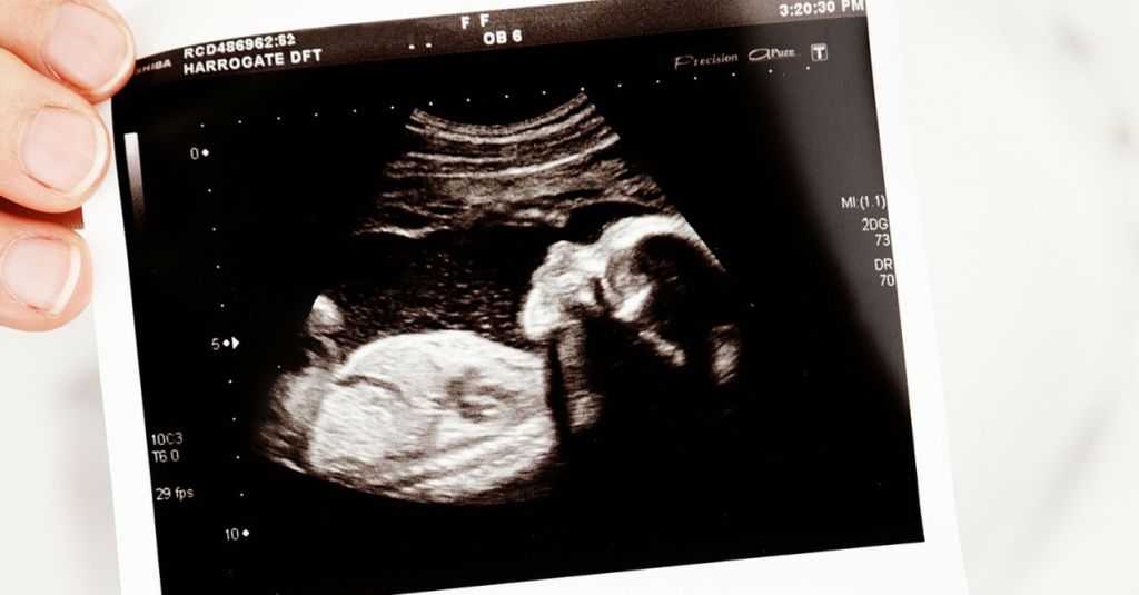 Producer Trey Sonogram